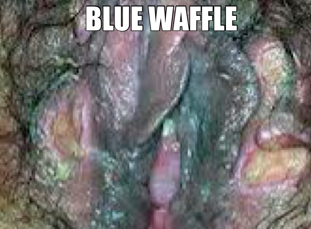 Blue Waffles Disease Images: Myth Busted | New Health Advisor